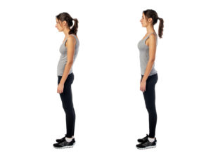Woman stands on left with poor posture; on right with correct posture